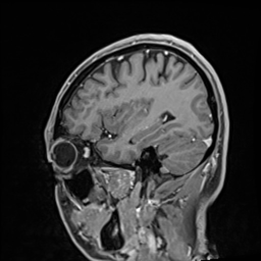 Click on the Serie image to view the images of VILLANUEVA, WILLIAM A.